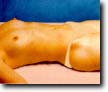 Body Treatment